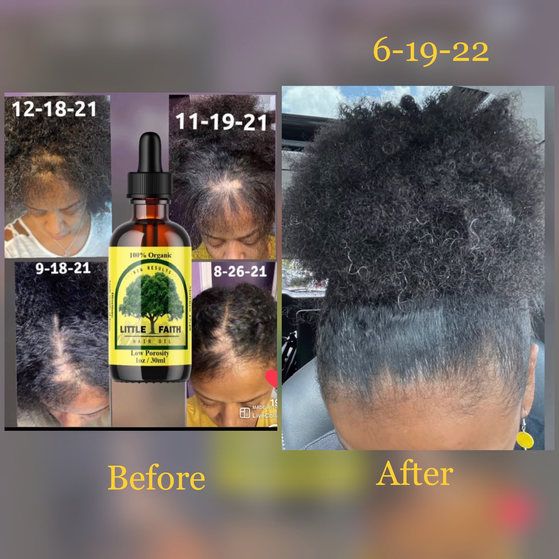 Customer alopecia results photo 1