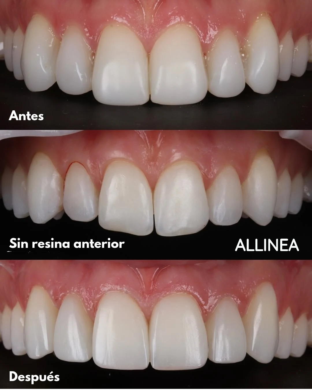 Antes y después — Paciente