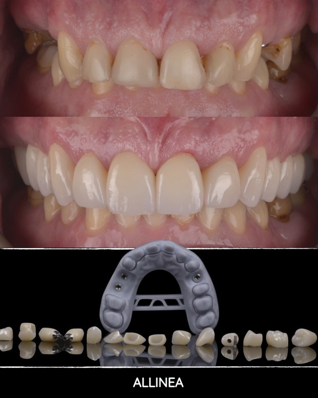 Antes y después — Sofía