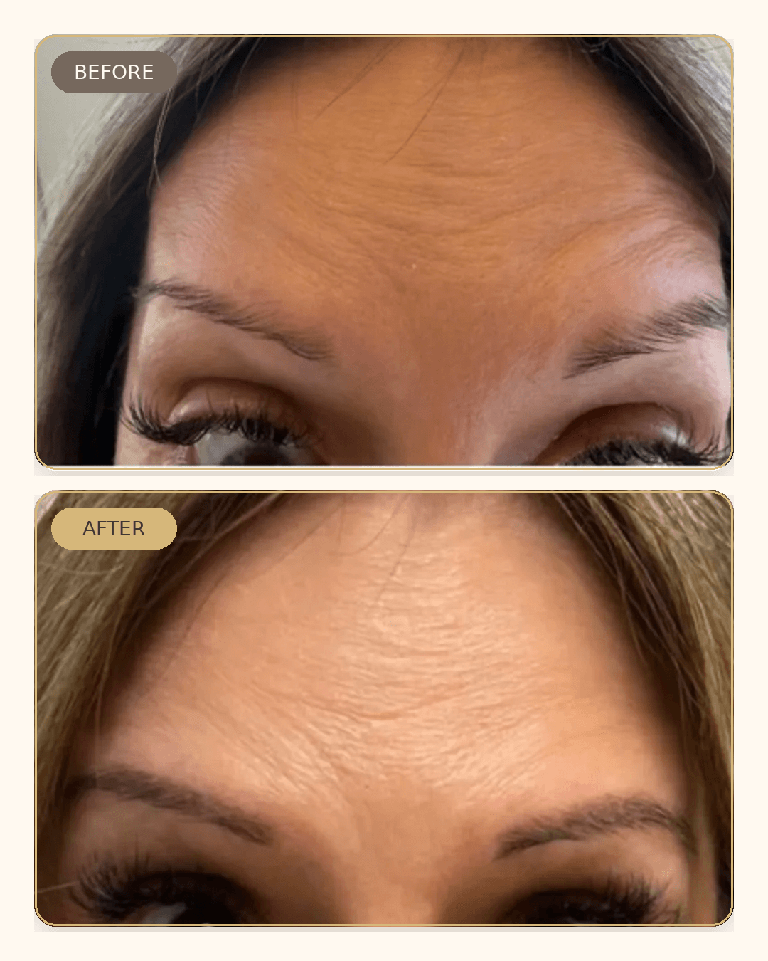 Before and after result 1