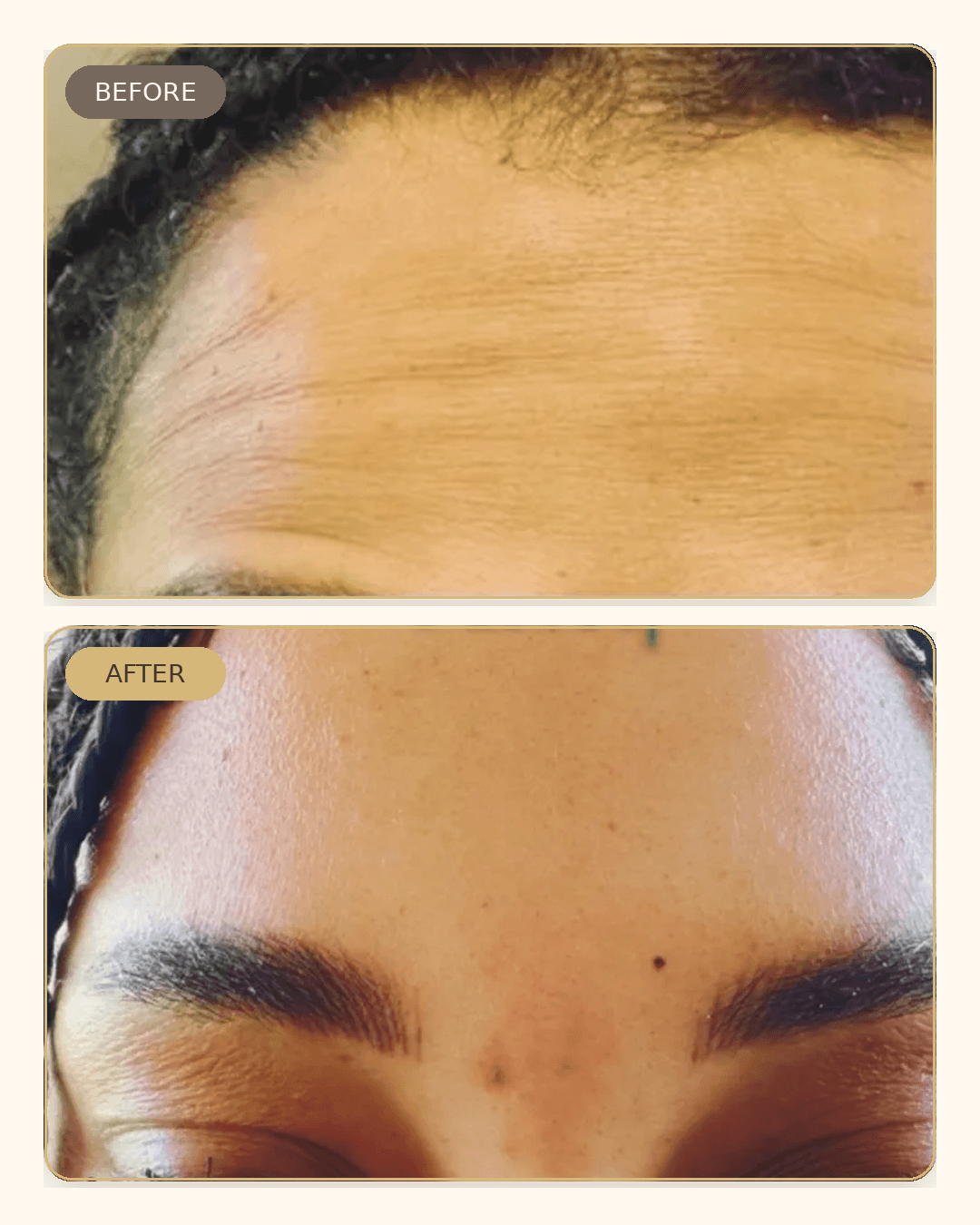 Before and after result 4