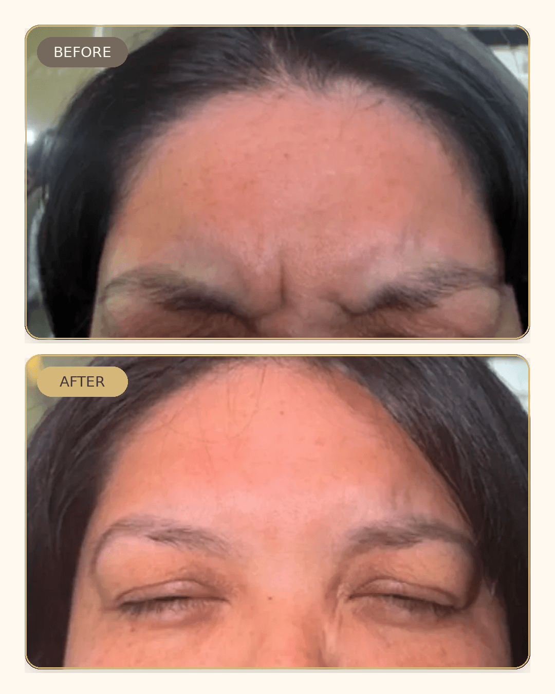 Before and after result 6