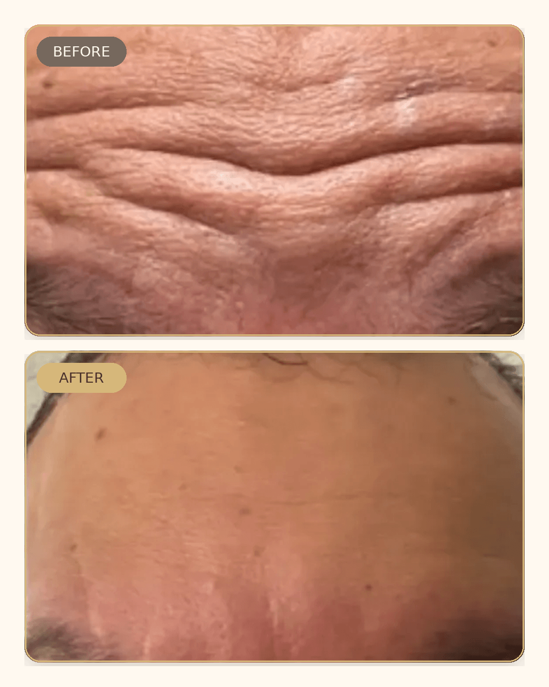 Before and after result 5