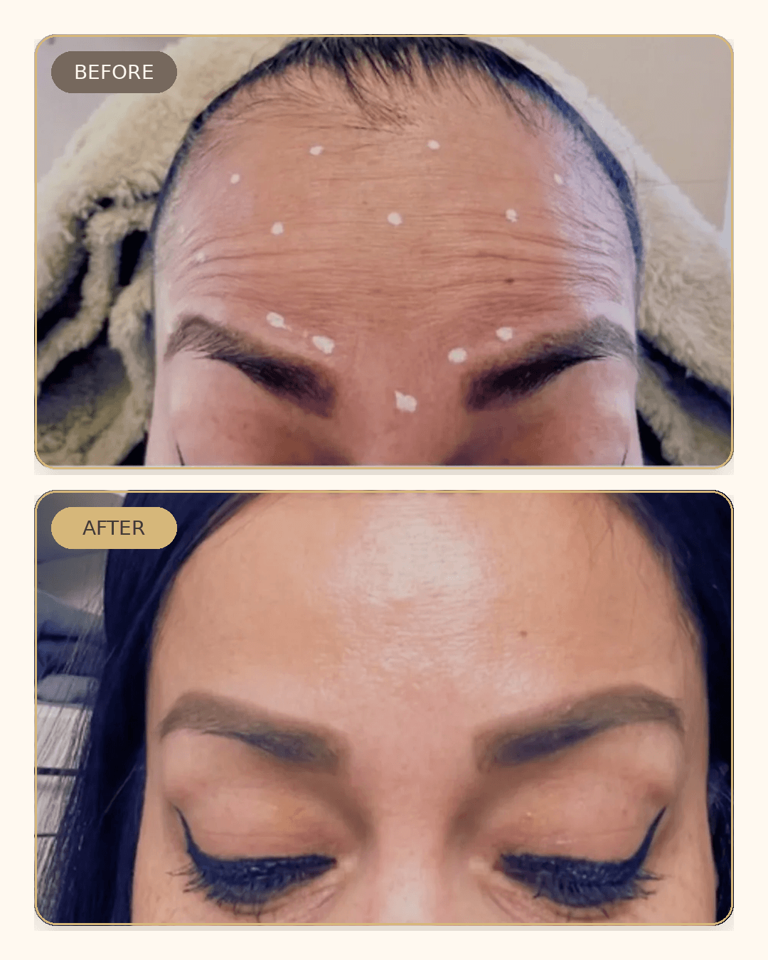 Before and after result 2