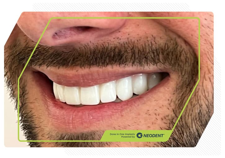 Done In One Transformation Result 3