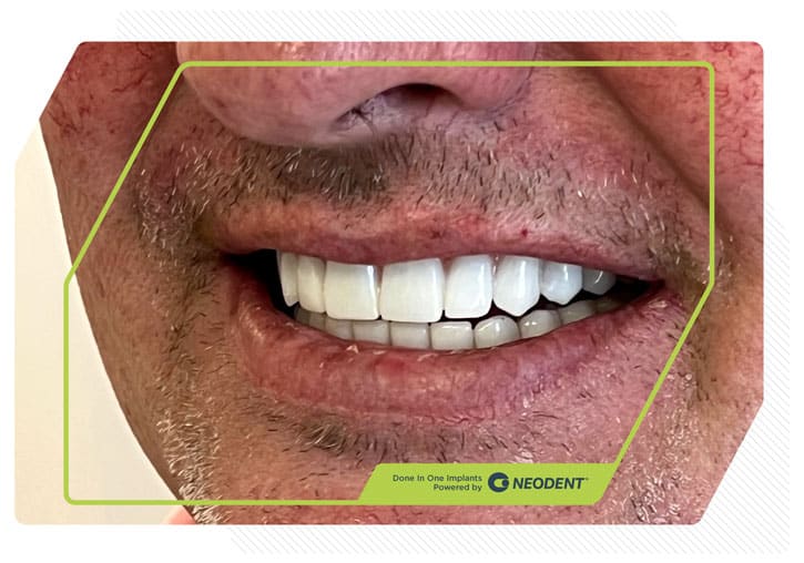 Done In One Transformation Result 1
