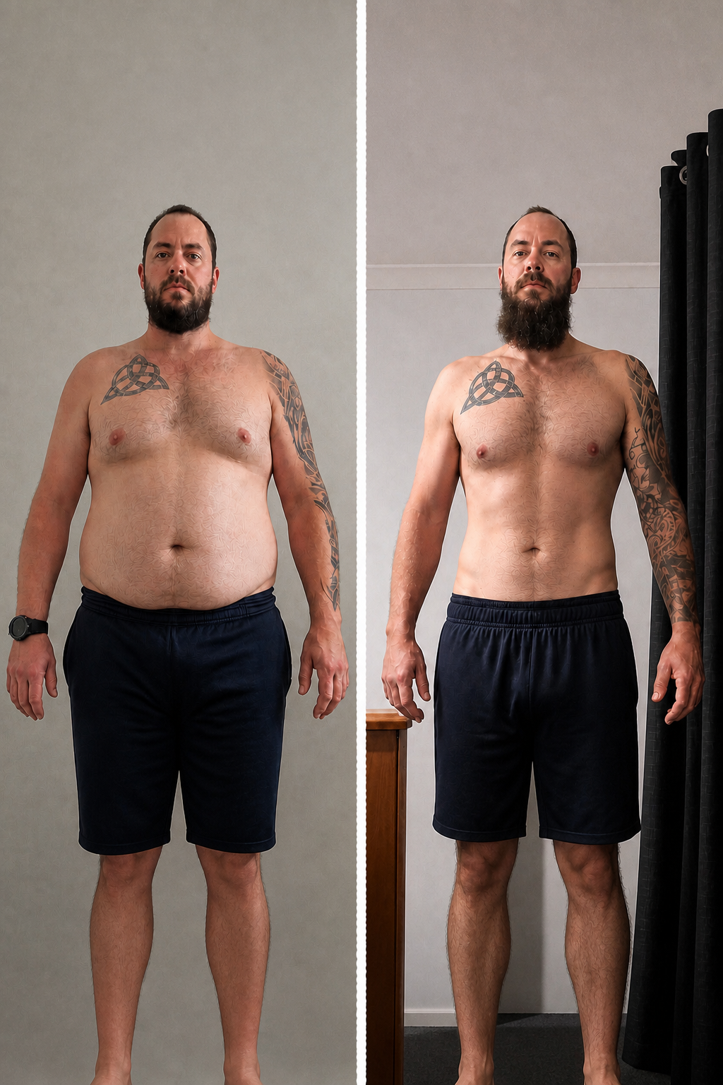 Transformation Méthode APEX