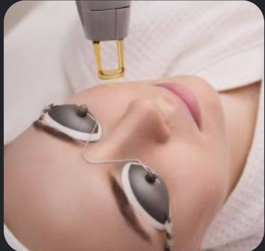 The Laserie signature laser facial with the GentleMax Pro Plus
