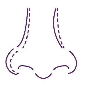 asymmetry or crooked shaped nose