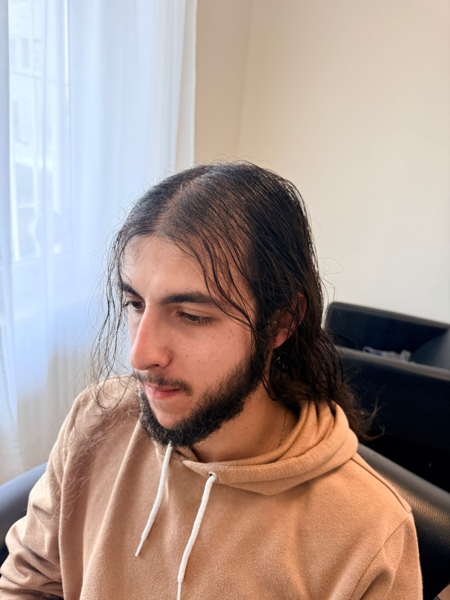 Dopo - Infoltimento caso 1