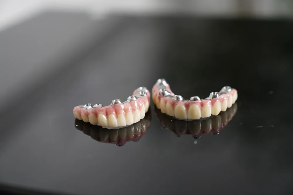 Full mouth implant bridges at GM Dental Implant Centre Barnet