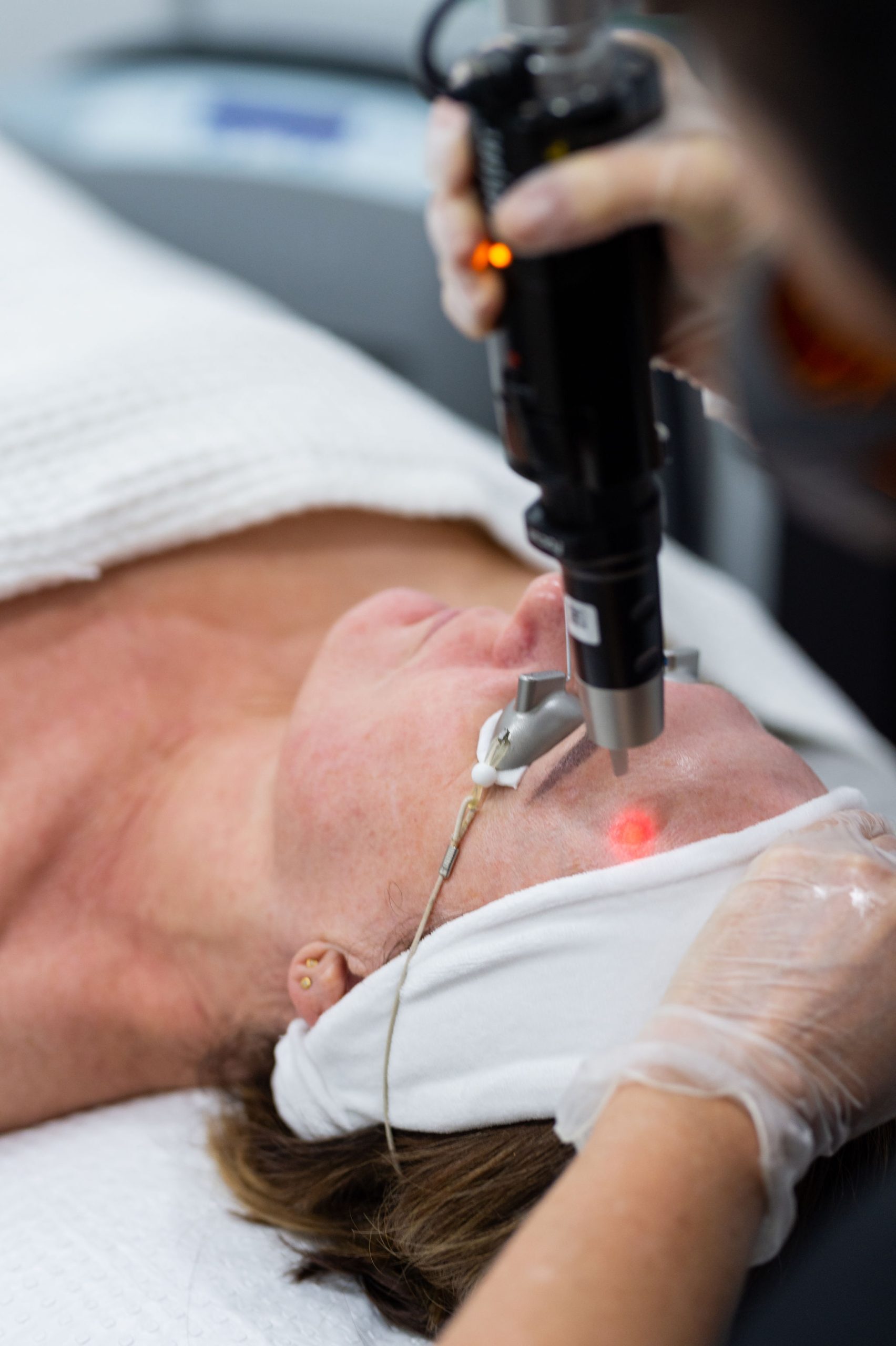 PicoSure laser skin treatment at Laser Skin Centre Bilinga