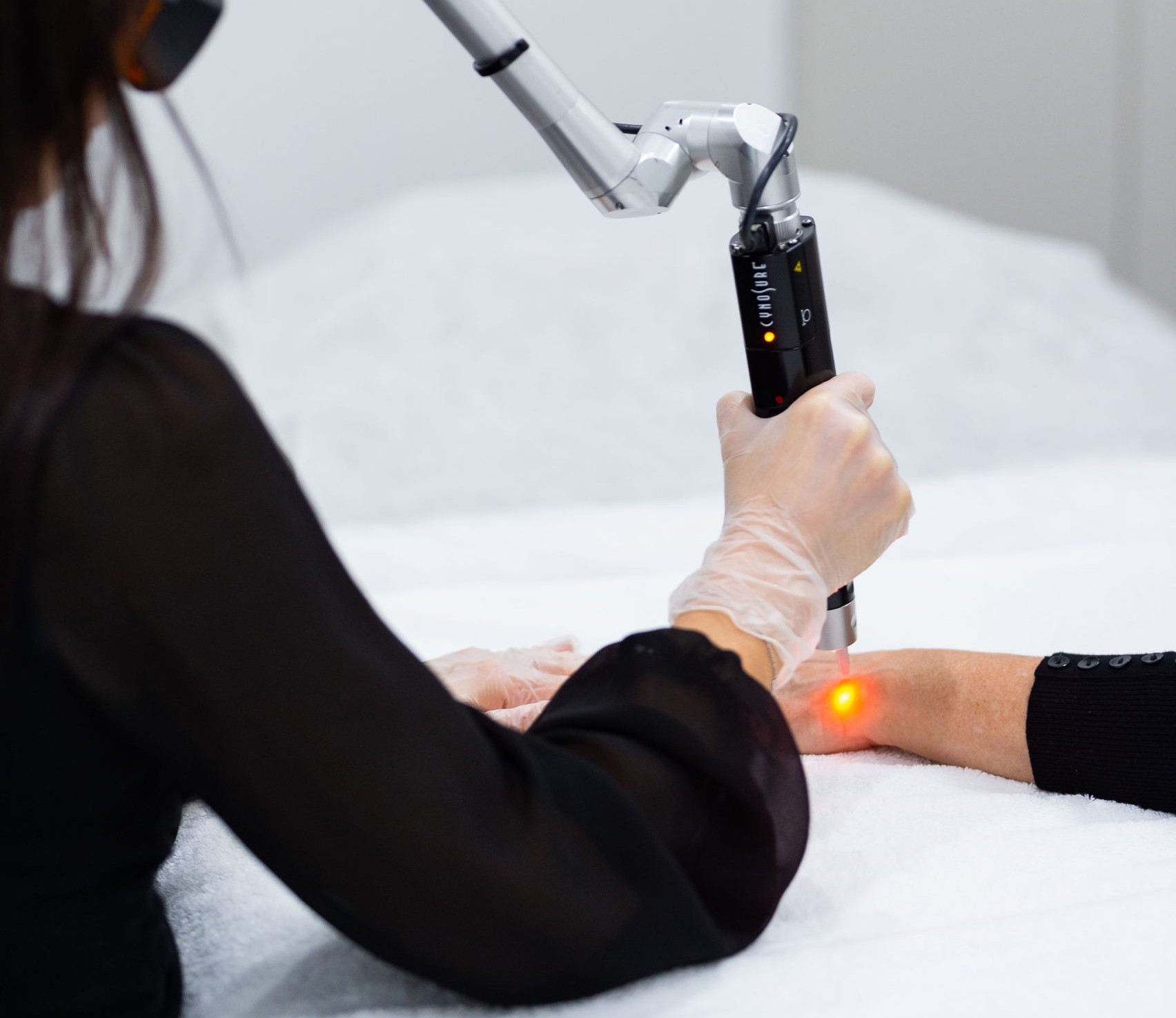 Accredited laser technician performing PicoSure tattoo removal at Laser Skin Centre Bilinga QLD