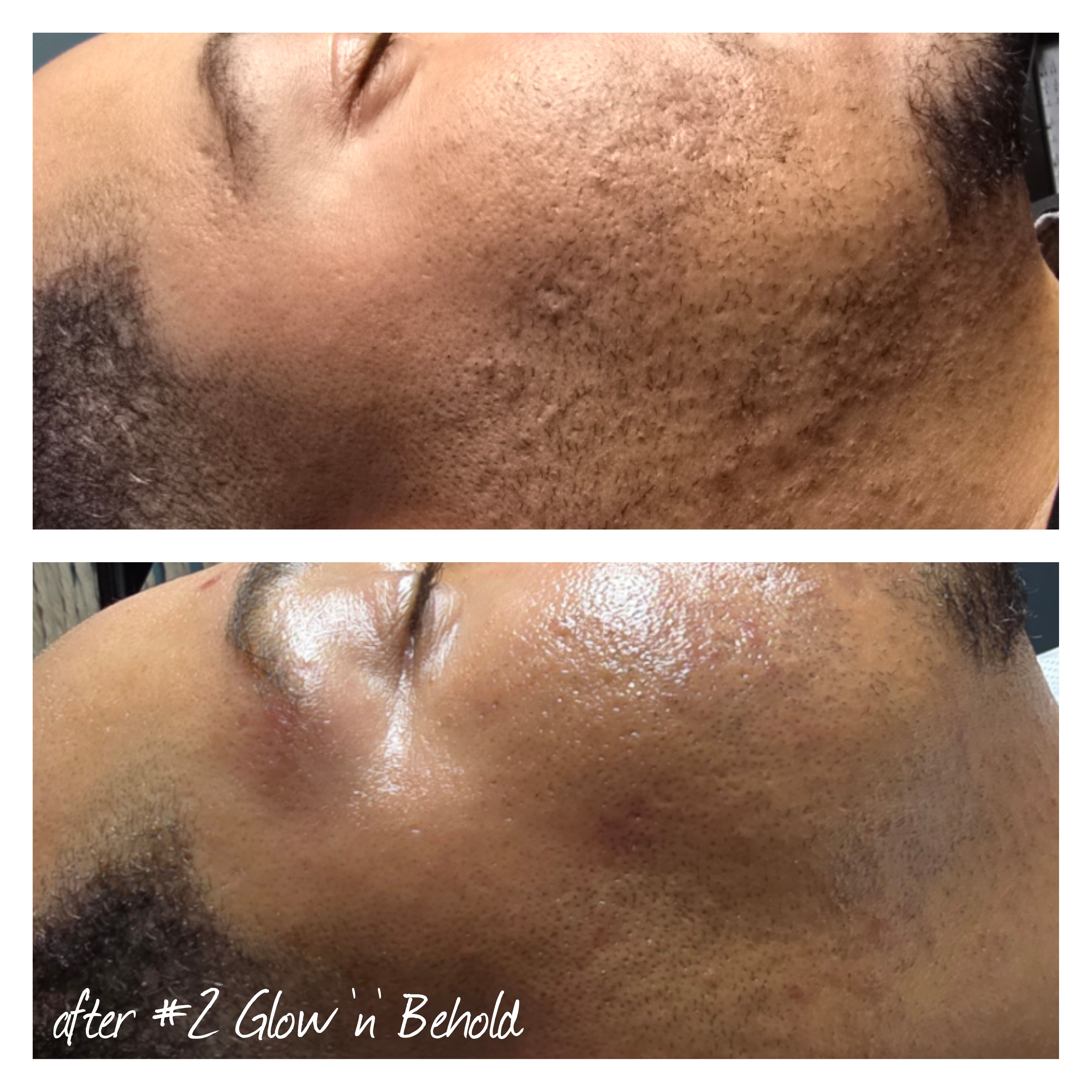 close-up of textured facial skin showing signs of inflammation and imbalance