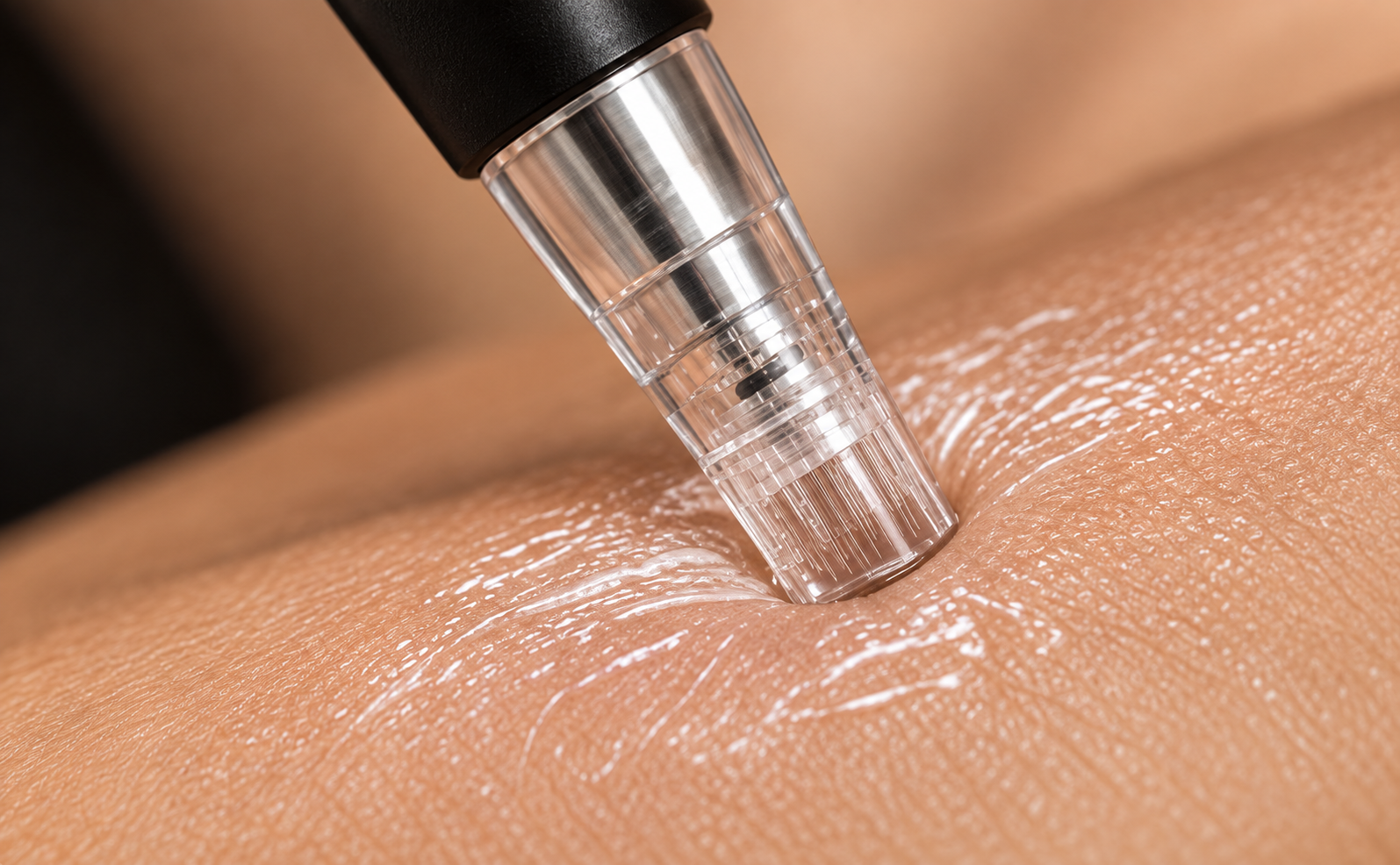 Microneedling skin treatment