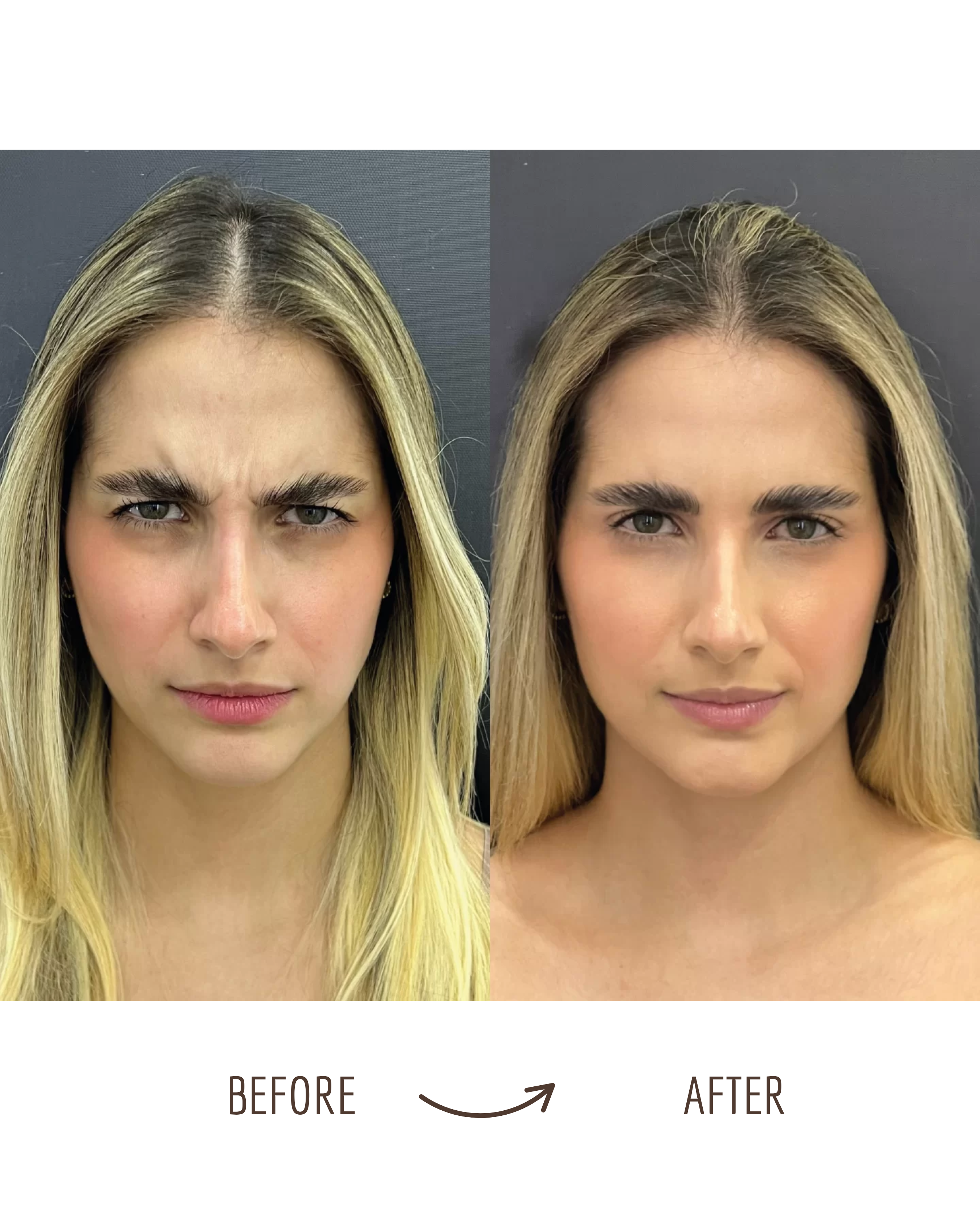 Before and after natural refreshed result