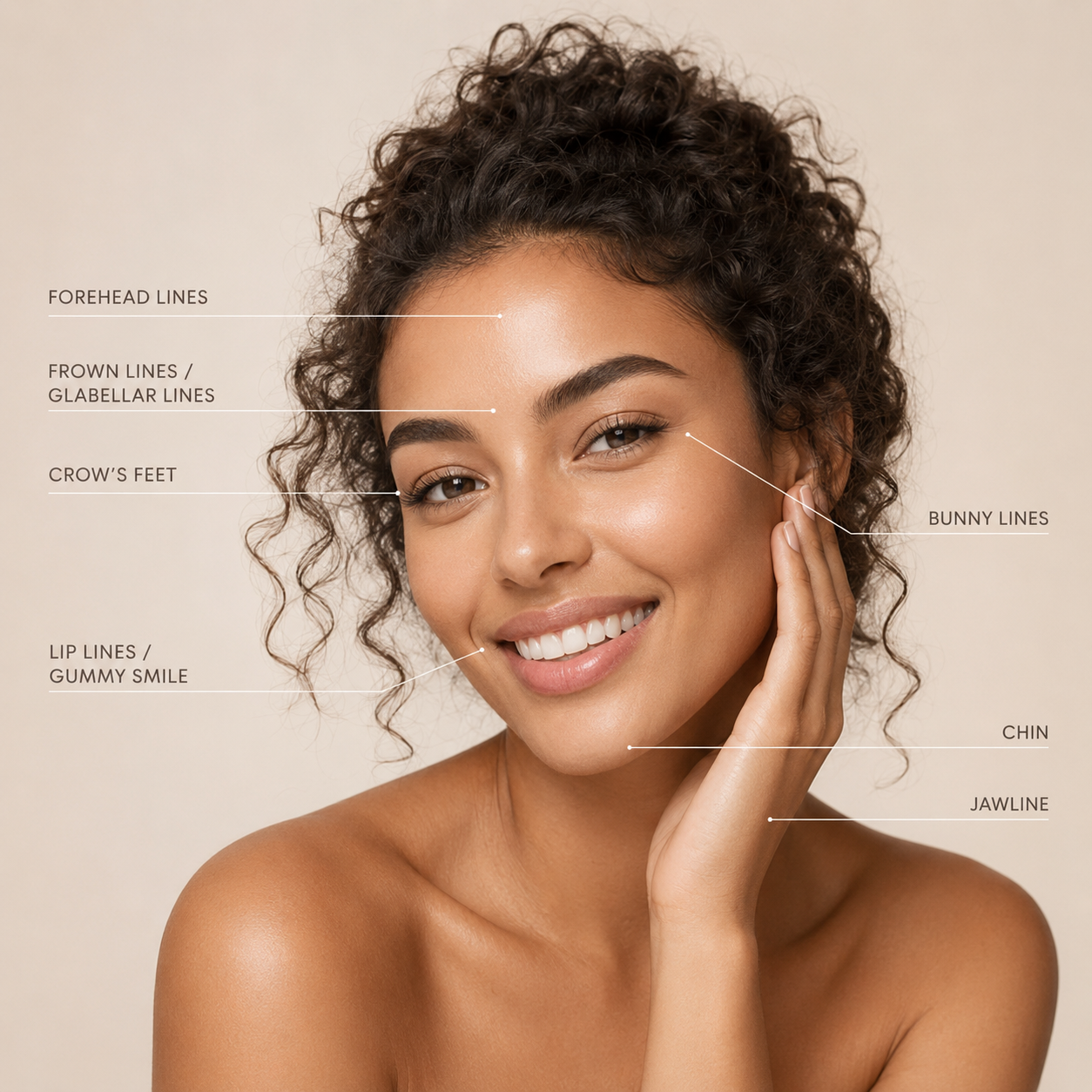 Wrinkle relaxer treatment areas