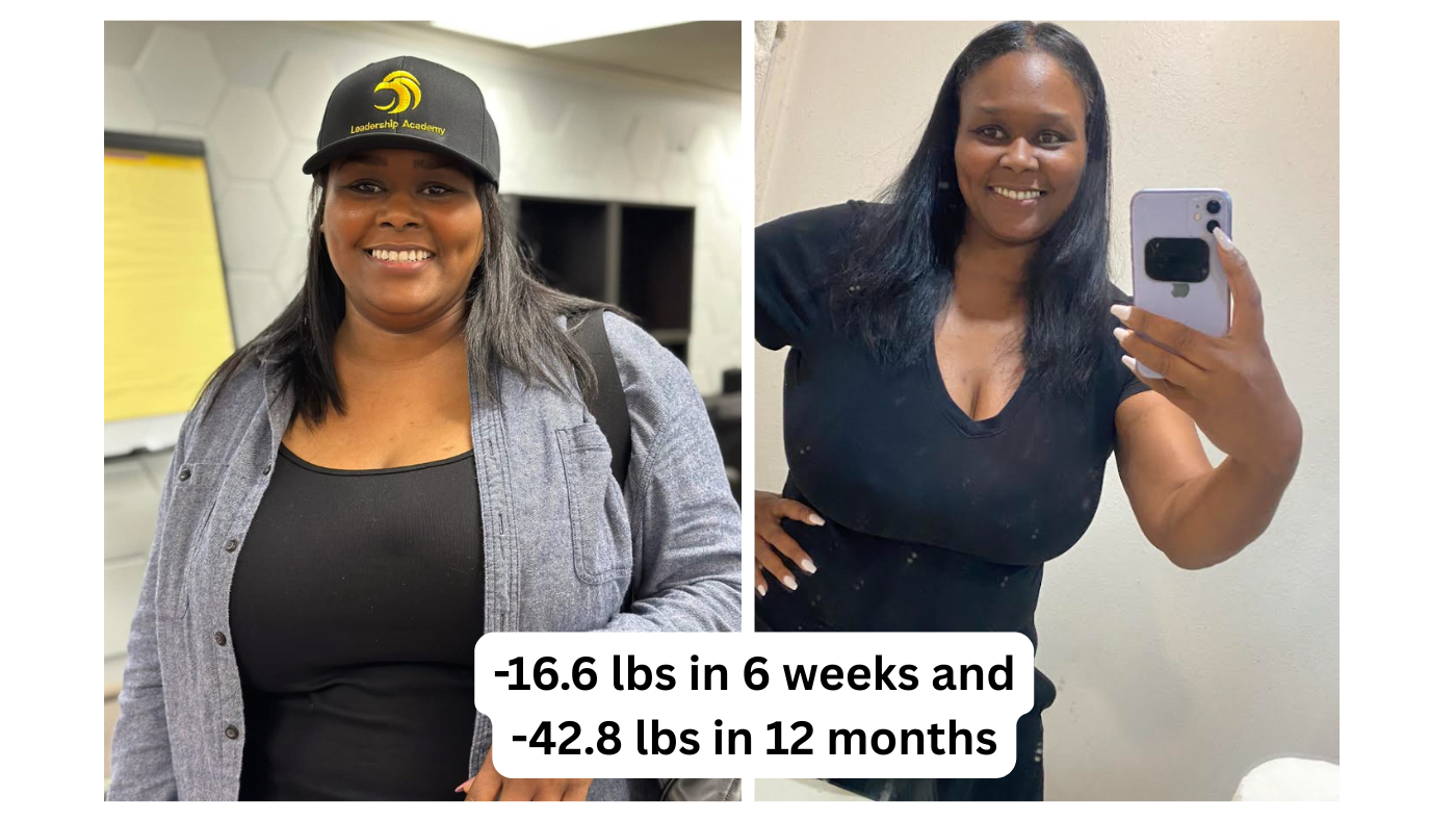 Shara Douglas before and after