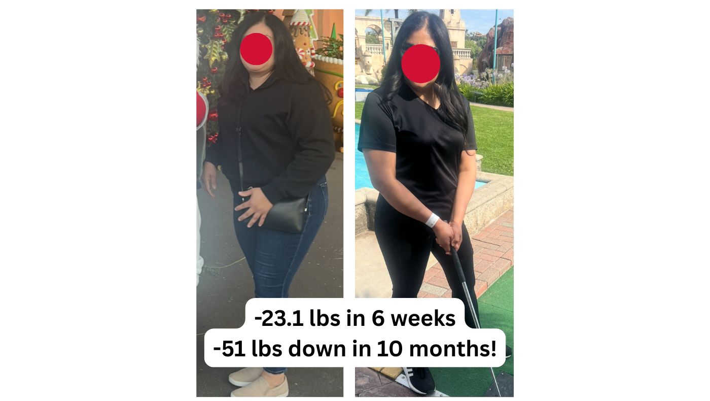 Daisy C. before and after