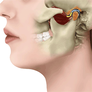 TheraCave physical therapist performing TMJ treatment