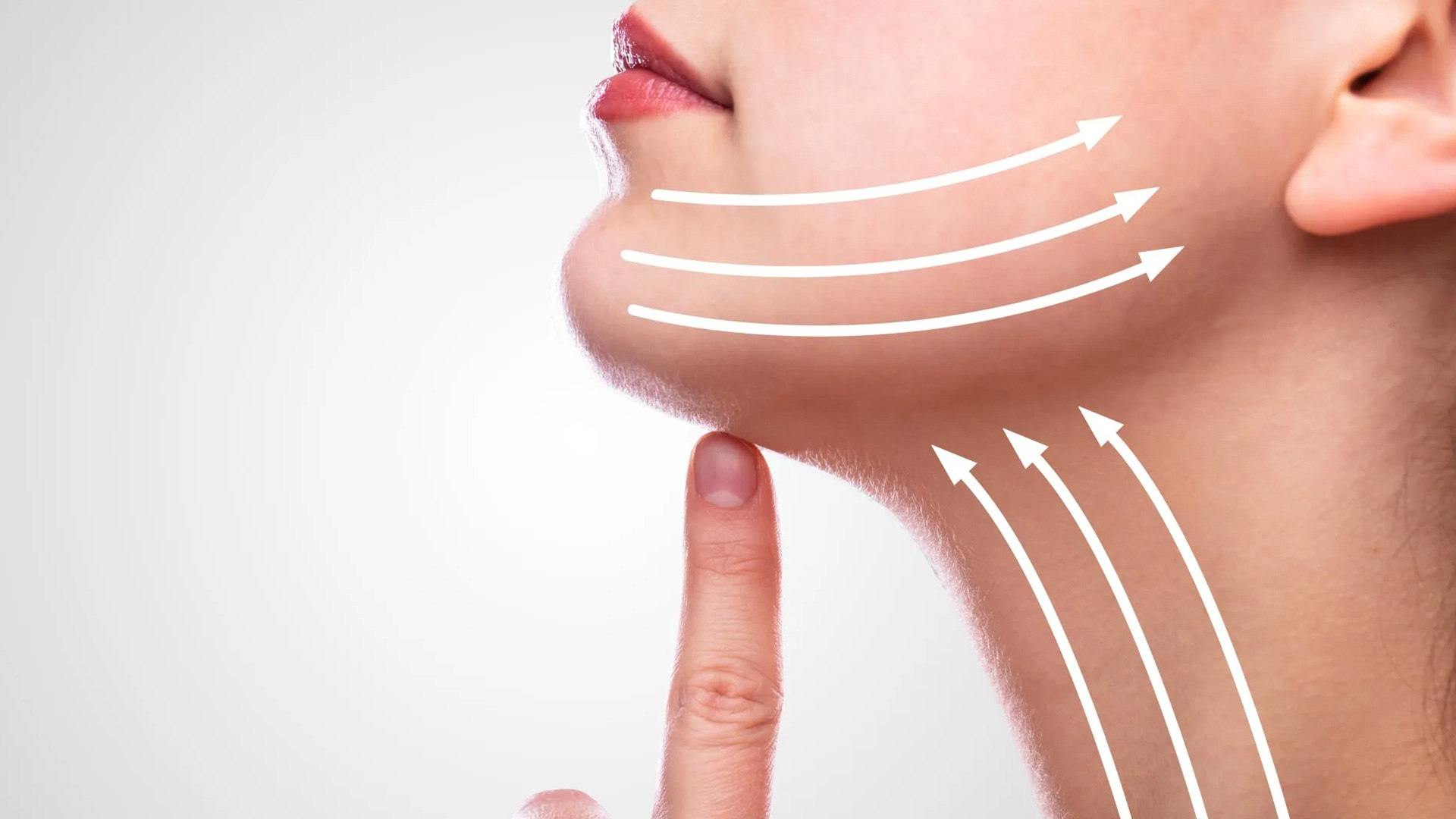 Lipoaspiração Cervico-facial