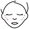 Lateral de Orbita