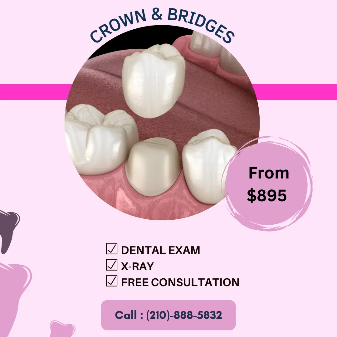 dental crown