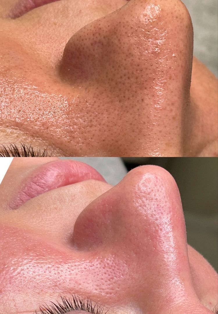 Resultado antes y después en beauté
