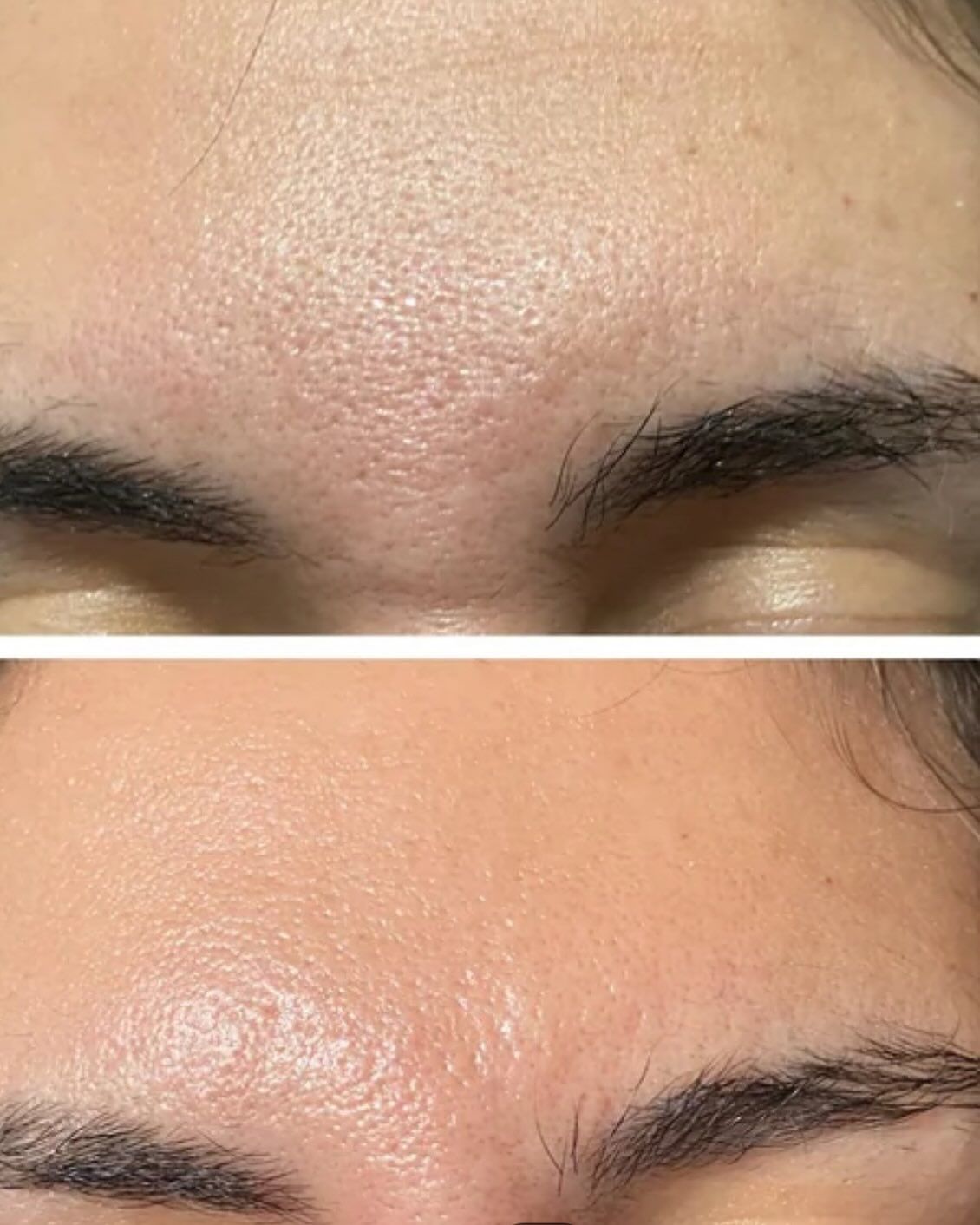Resultado antes y después en beauté