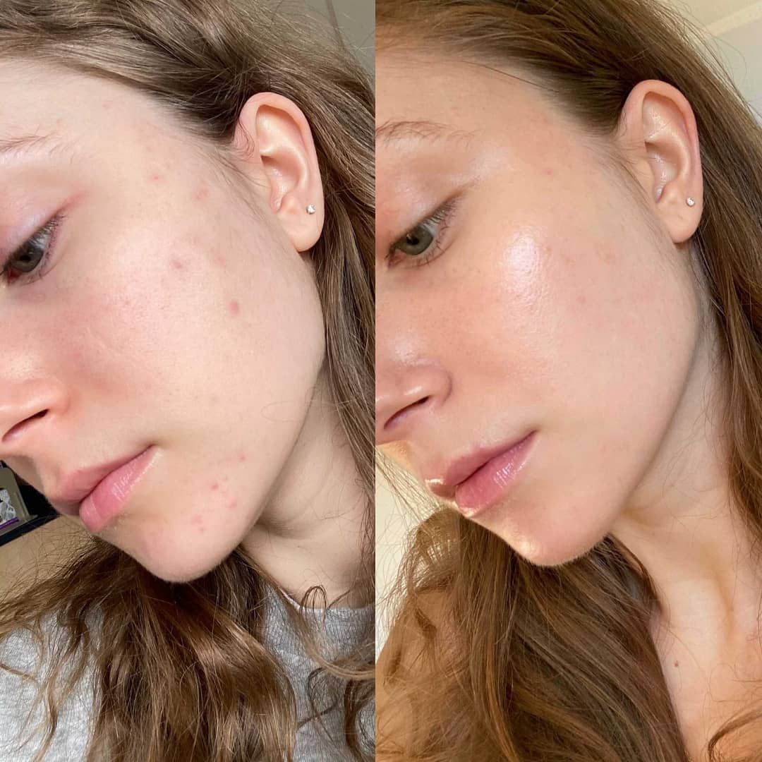 Resultado antes y después en beauté