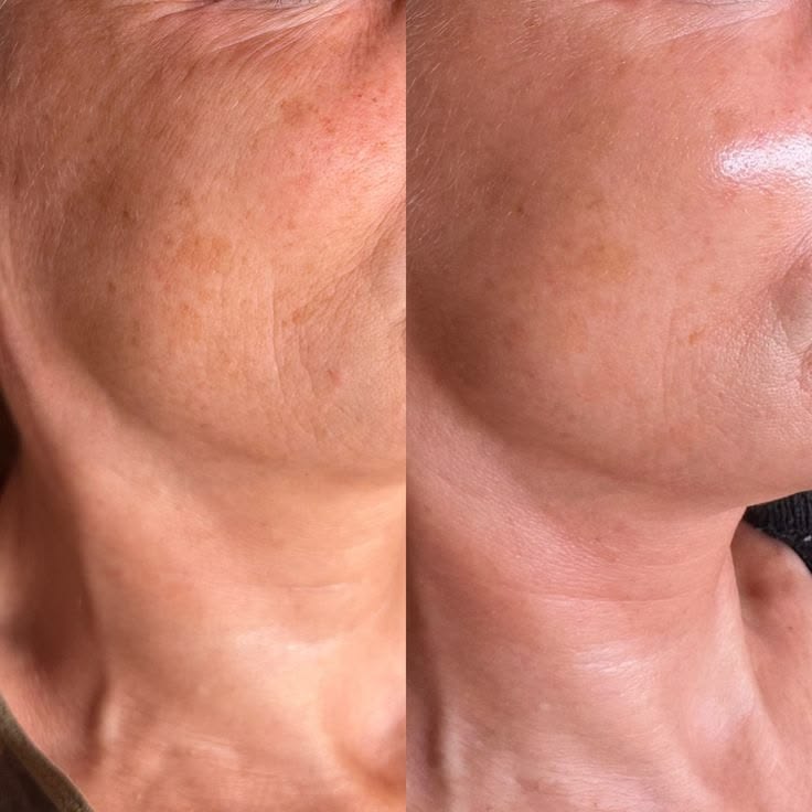 Resultado antes y después en beauté