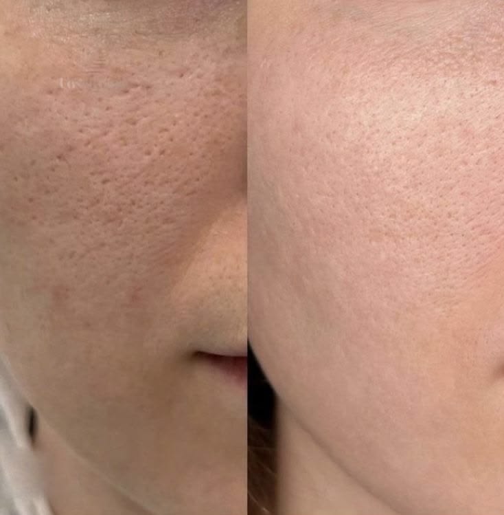 Resultado antes y después en beauté