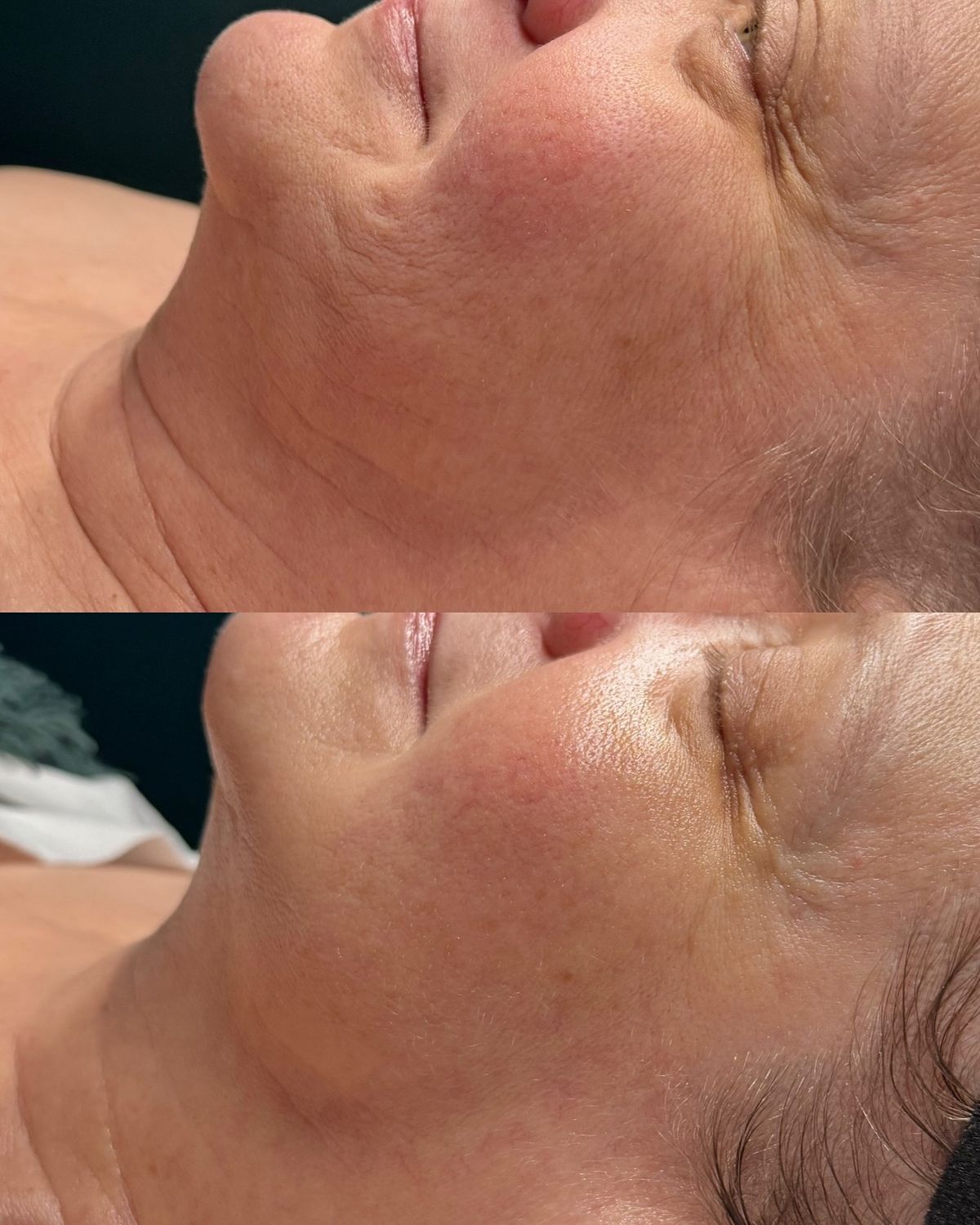 Resultado antes y después en beauté
