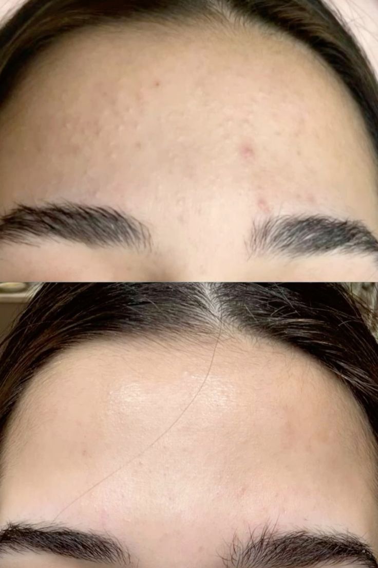Resultado antes y después en beauté