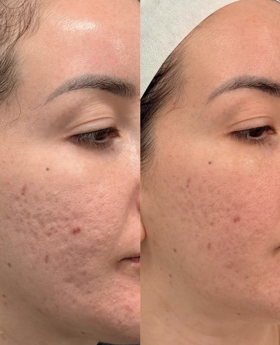 Resultado antes y después en beauté