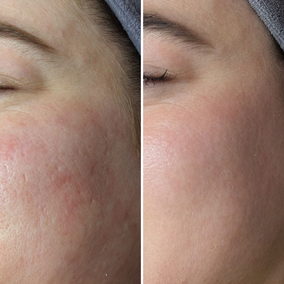 Resultado antes y después en beauté