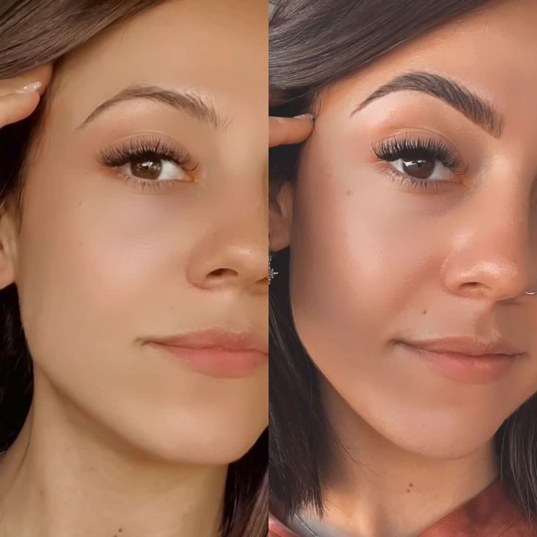 Before & after