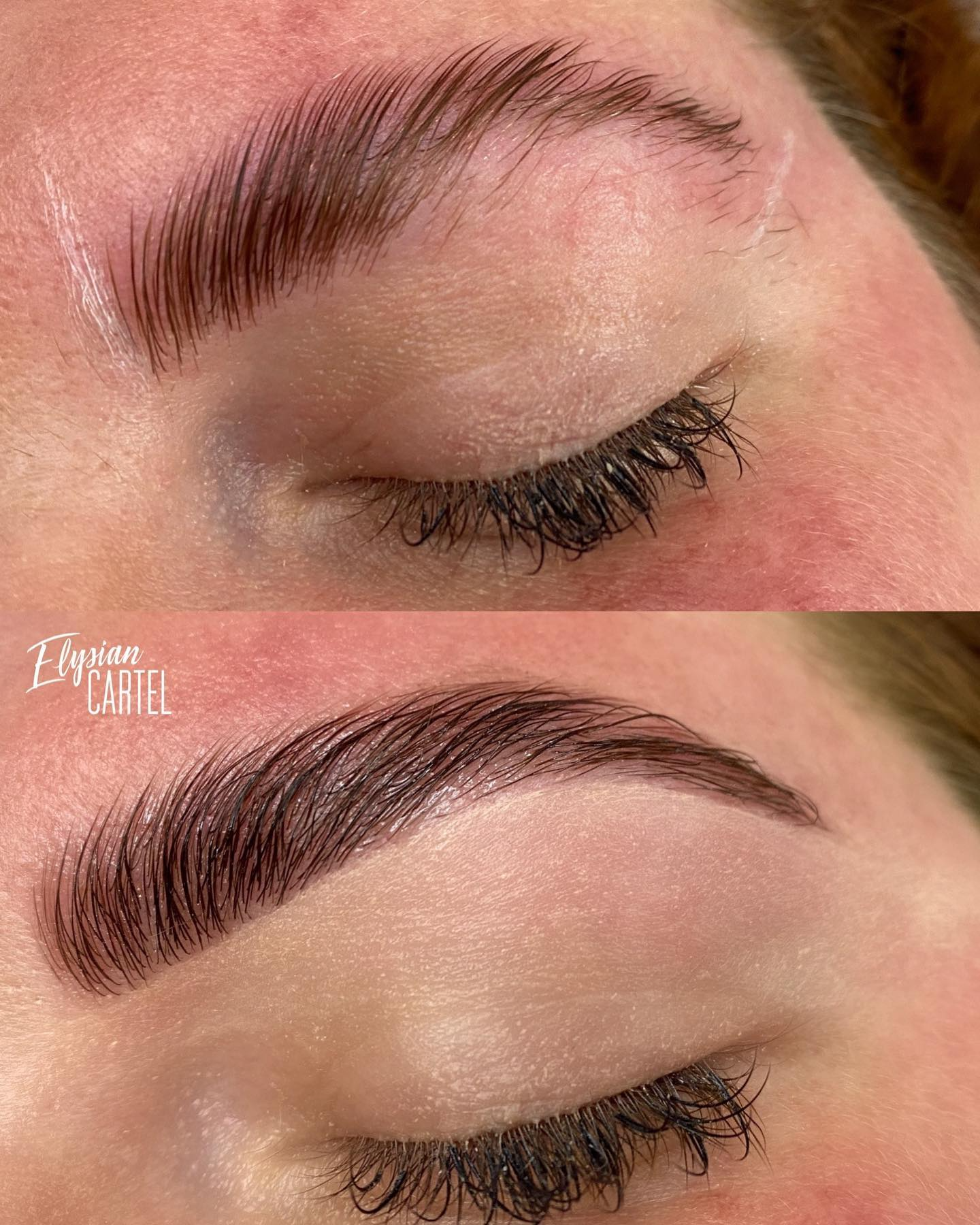 Before & after
