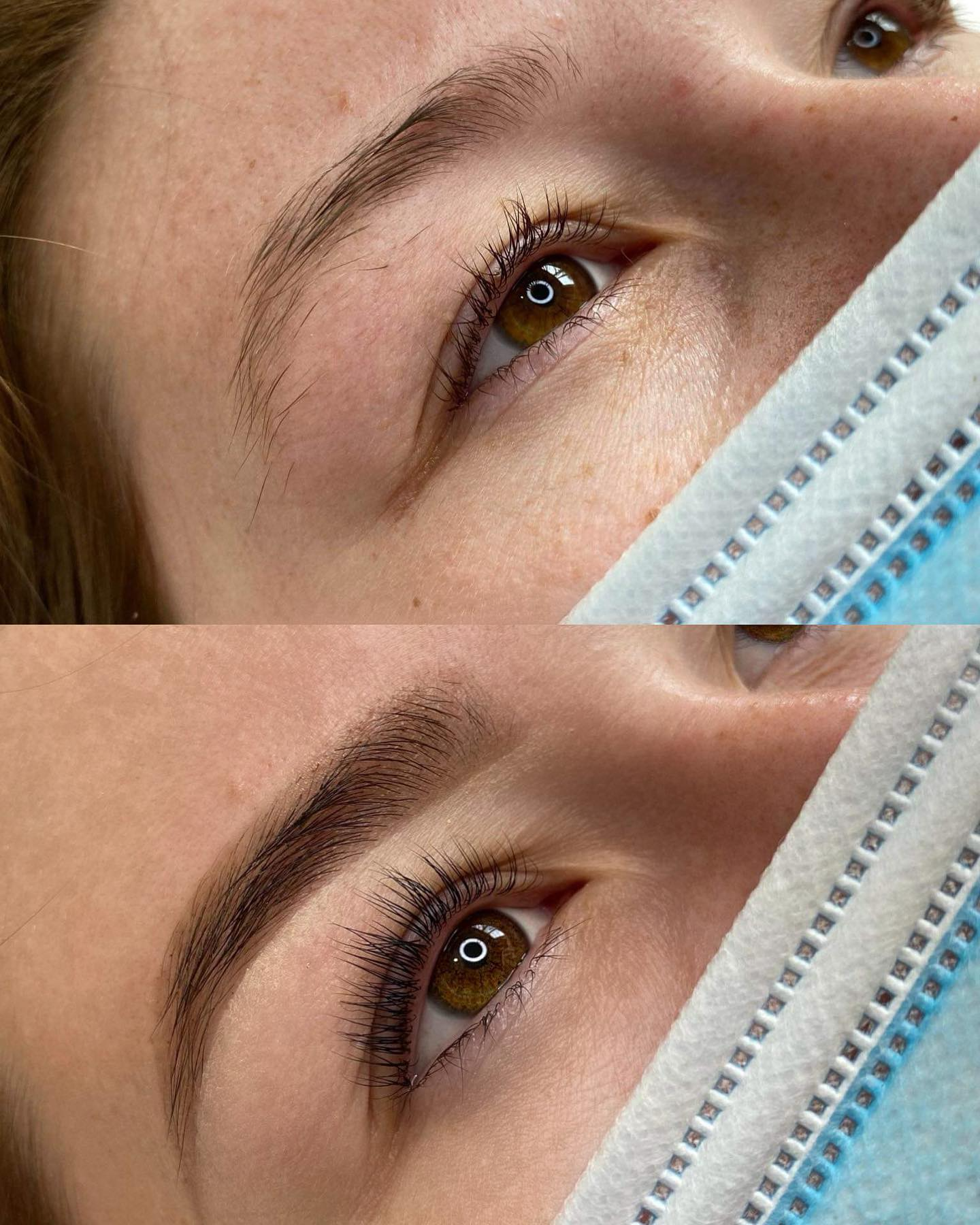 Before & after