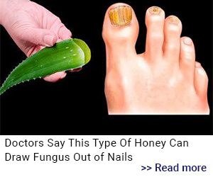 Pronailcomplex-toe-fungus-image