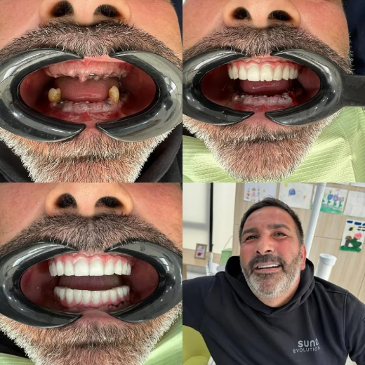 Risultato 3