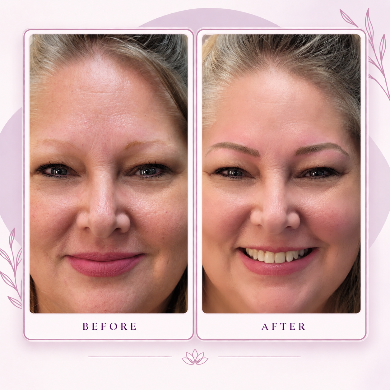 Before and after an immediate post-procedure permanent makeup result on mature skin