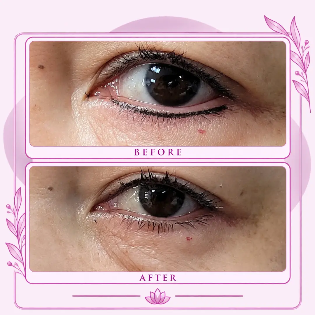 Before-and-after comparison of a brown eye showing eyeliner appearance along the upper and lower lash lines