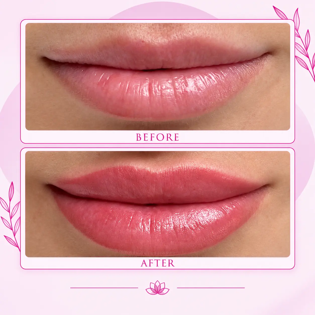 Lip blush before and after comparison — healed natural lip color result one