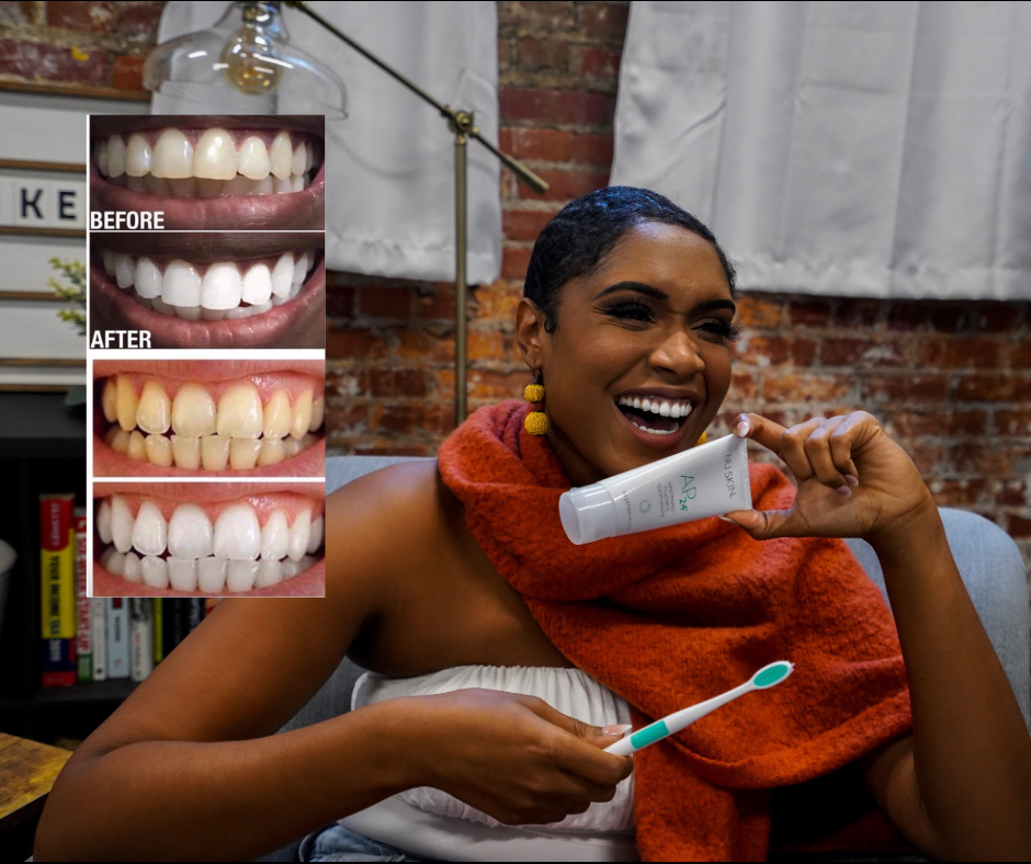 Smile Labs whitening smile-care routine