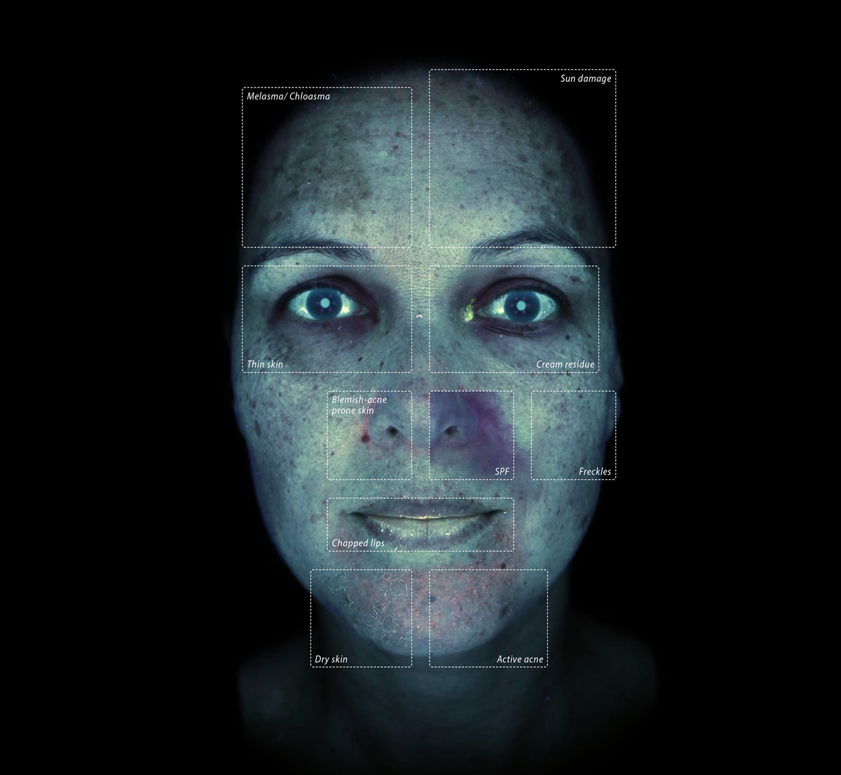 Alma IQ 3D skin analysis device showing facial mapping results.