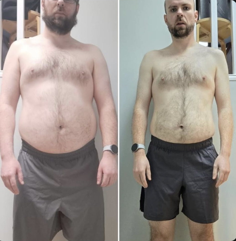 Transformation Protocole 20 — avant après