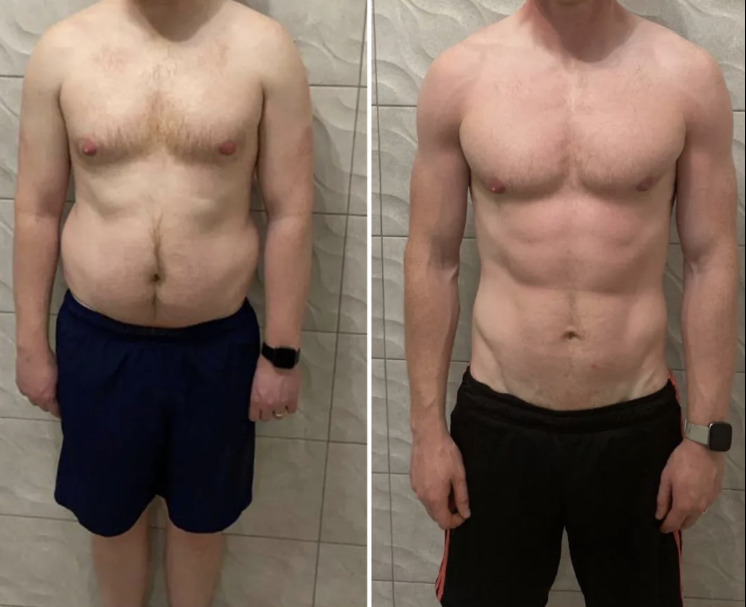 Transformation Protocole 20 — avant après