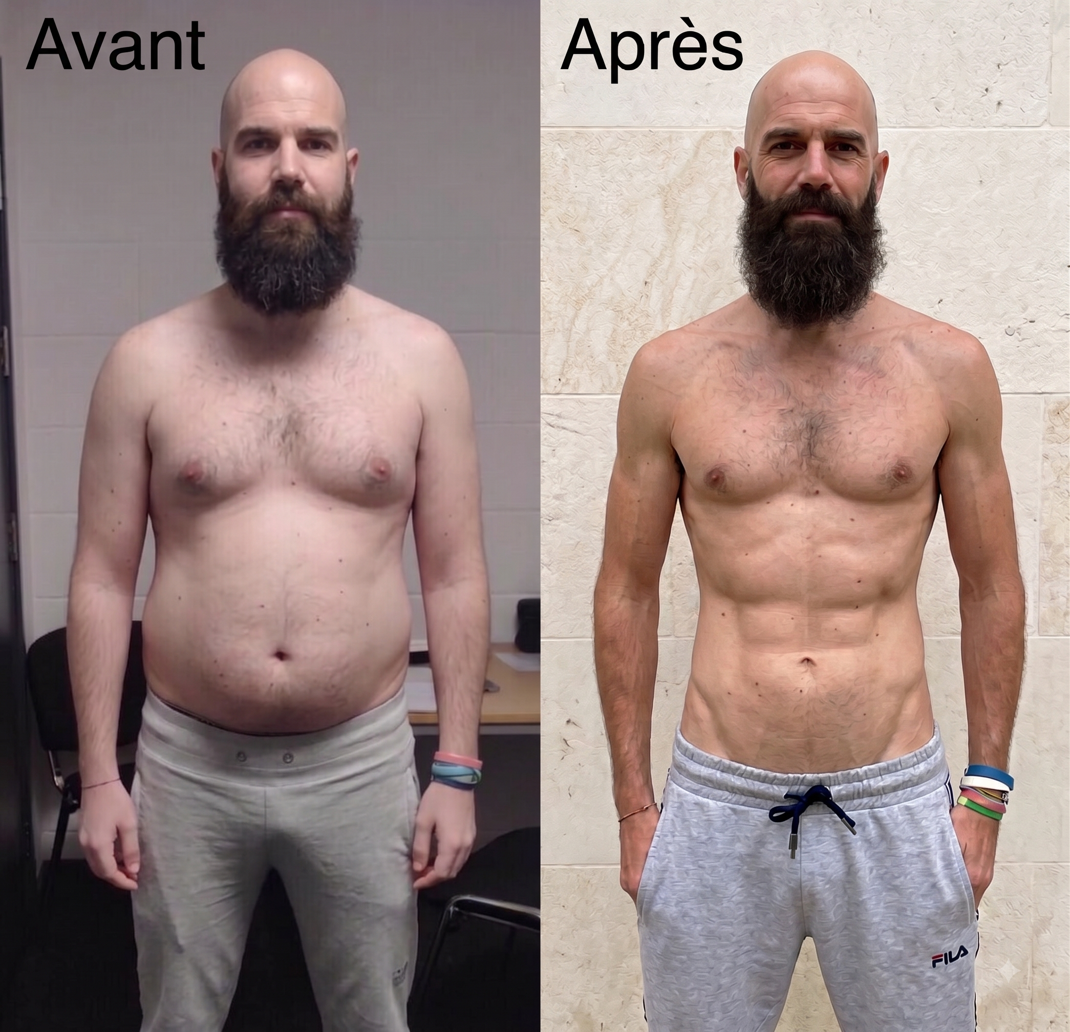 Transformation Protocole 20 — avant après
