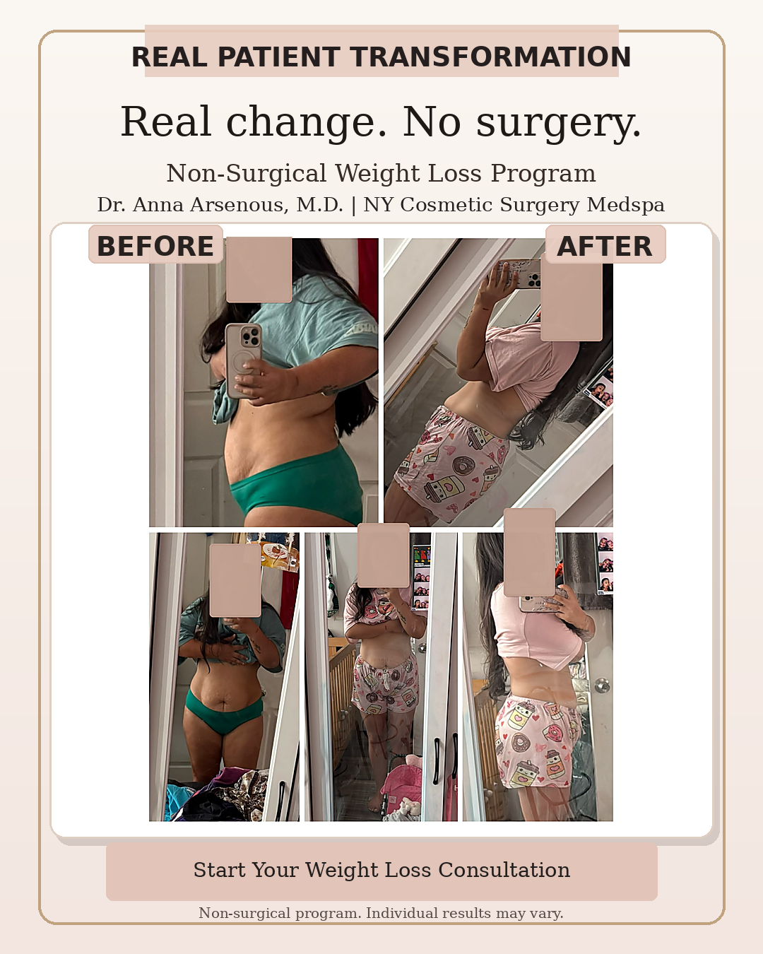Patient result on the medically supervised non-surgical weight loss program